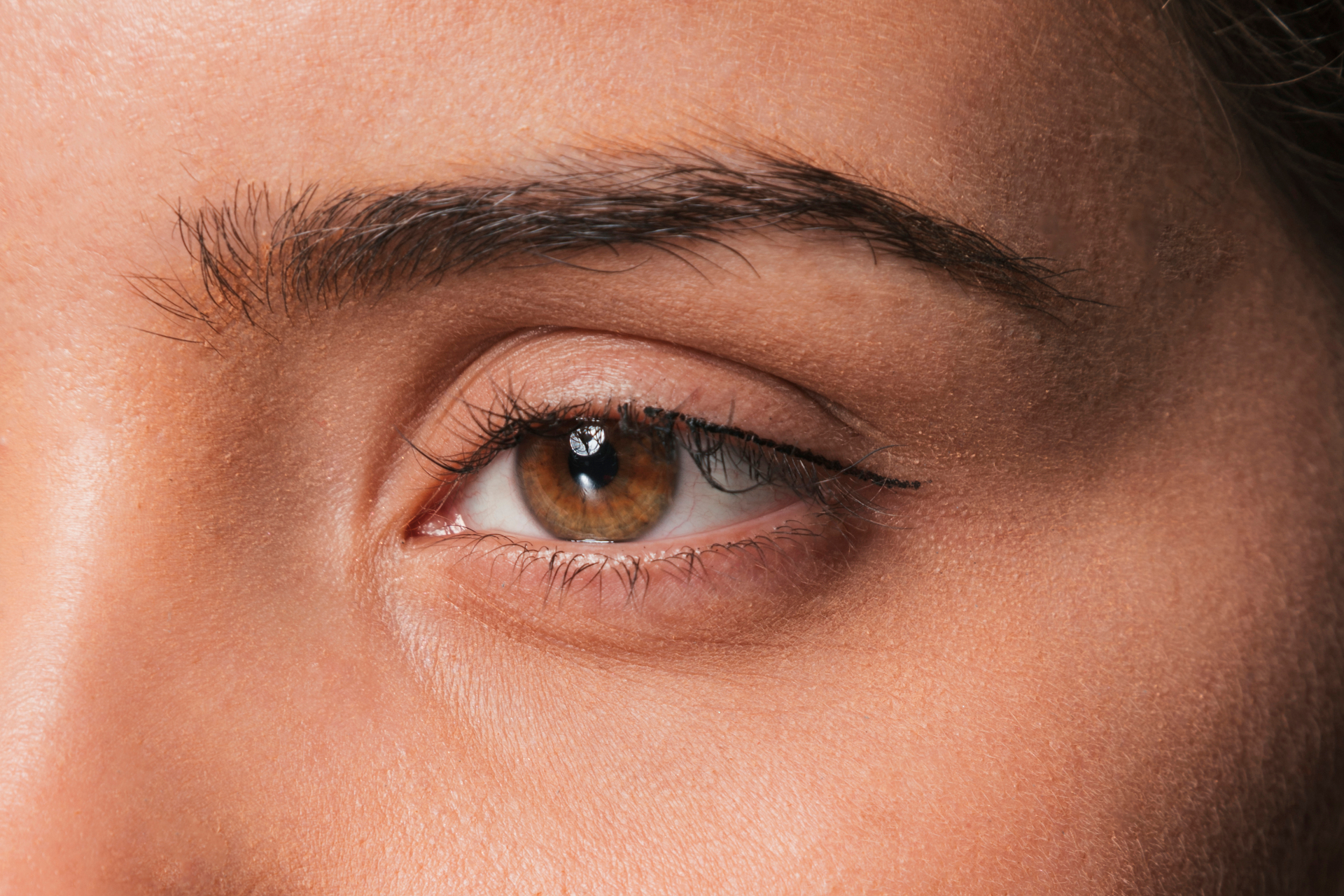 Resultado Fox Eyes — olhar elevado e harmônico